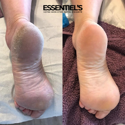 Masque Exfoliant Pieds Doux™ - Révélez la douceur de vos pieds!