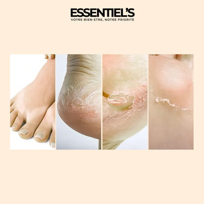 Masque Exfoliant Pieds Doux™ - Révélez la douceur de vos pieds!