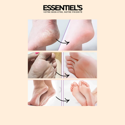 Masque Exfoliant Pieds Doux™ - Révélez la douceur de vos pieds!