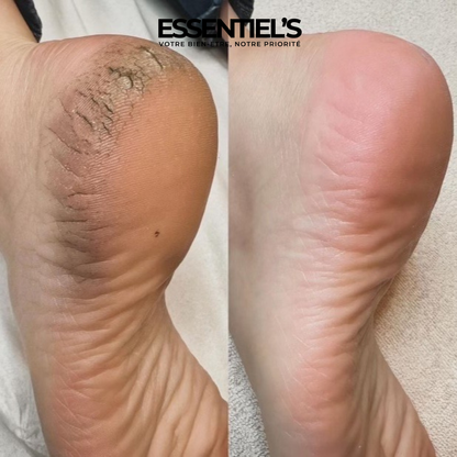 Masque Exfoliant Pieds Doux™ - Révélez la douceur de vos pieds!